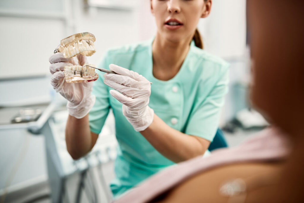 Implantologia dentale: differenza tra All on 4 e All on 6