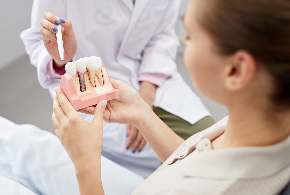Cosa succede dopo un impianto dentale? Guida al post-operatorio senza sorprese