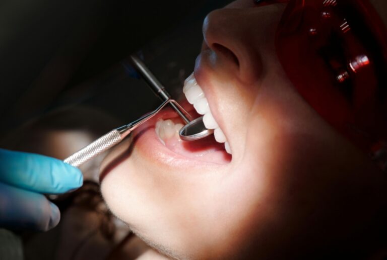 ogni quanto pulizia dentale