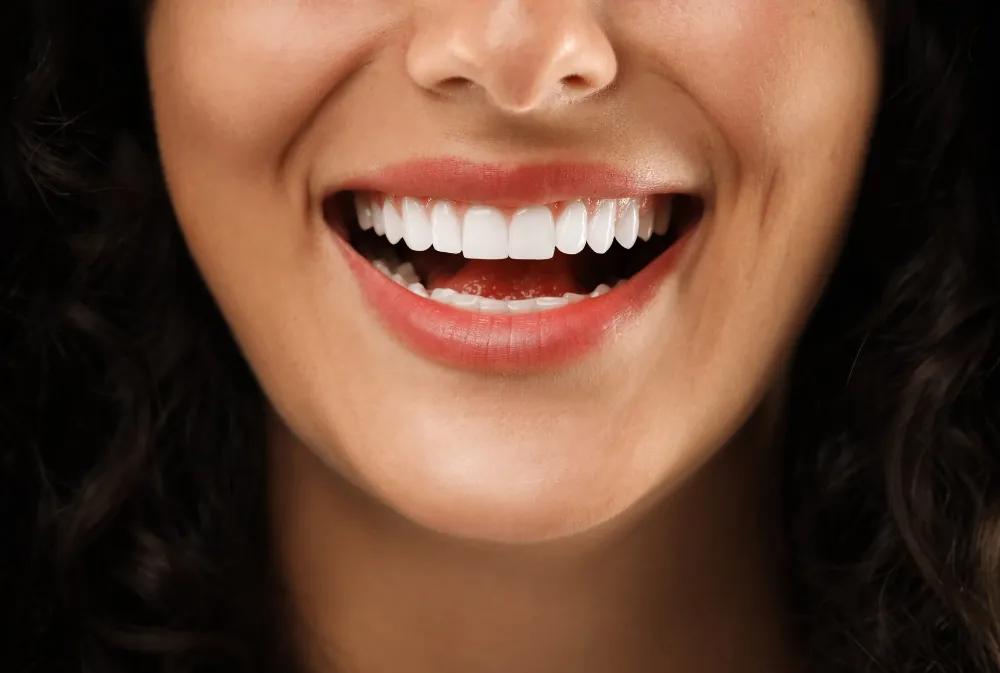 Estetica Dentale Estetica Dentale