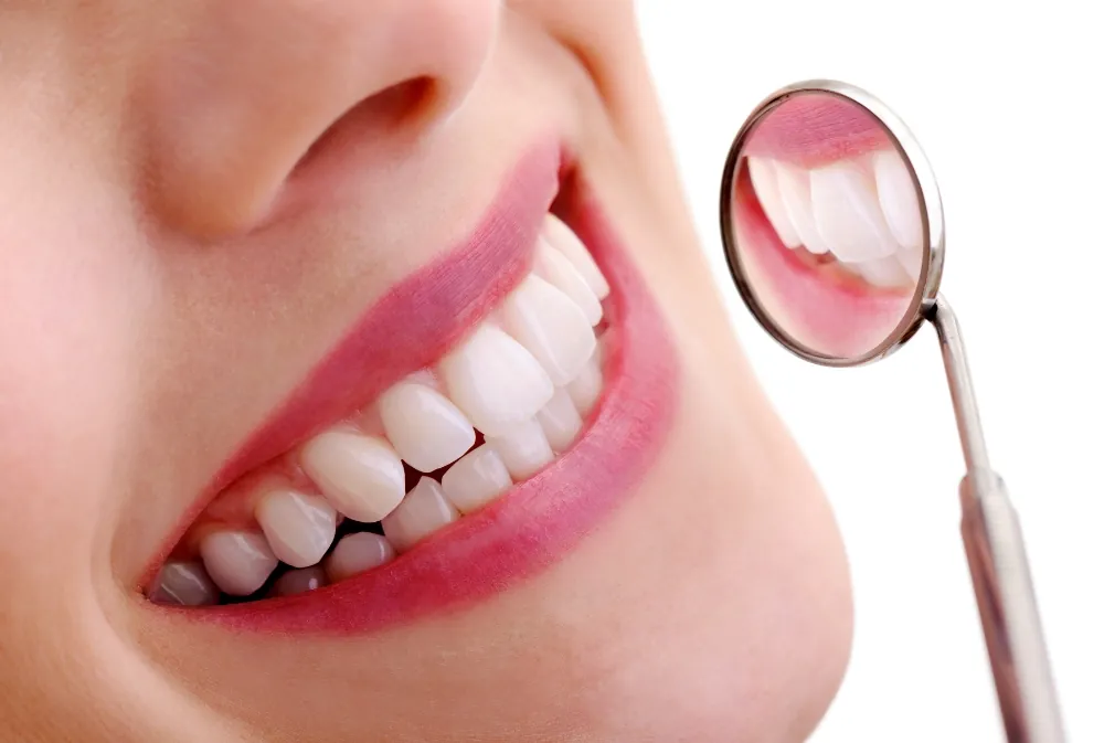 Faccette dentali: cosa sono, quando servono e come cambiano il sorriso